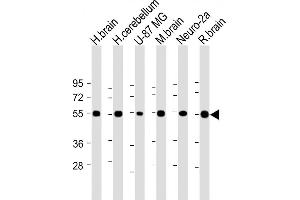 All lanes : Anti-NRXN1 Antibody (N-term) at 1:2000 dilution Lane 1: Human brain lysate Lane 2: Human cerebellum lysate Lane 3: U-87 MG whole cell lysate Lane 4: Mouse brain lysate Lane 5: Neuro-2a whole cell lysate Lane 6: Rat brain lysate Lysates/proteins at 20 μg per lane. (Neurexin 1 antibody  (N-Term))