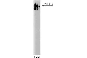 Western blot analysis of Ki-67 on a HeLa lysate (ABIN968535). (Ki-67 antibody  (AA 1547-1742))