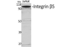 Western Blot analysis of various cells using Integrin β5 Polyclonal Antibody diluted at 1:1000. (Integrin beta 5 antibody  (AA 690-770))