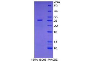 SDS-PAGE (SDS) image for CD302 (CD302) (AA 21-225) protein (His tag) (ABIN2124187) (DCL1 Protein (AA 21-225) (His tag))