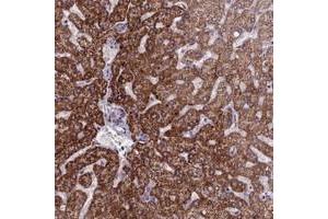 Immunohistochemical staining of human liver with FBRS polyclonal antibody  shows strong cytoplasmic positivity in hepatocytes at 1:20-1:50 dilution.
