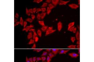 Immunofluorescence analysis of HeLa cells using SLC35A2 Polyclonal Antibody (SLC35A2 antibody)