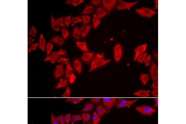 SLC35A2 antibody