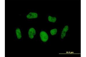 Immunofluorescence of  purified  MaxPab antibody to BRD3 on HeLa cell. (BRD3 antibody  (AA 1-556))