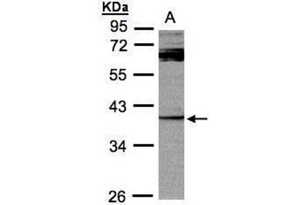 DUSP7 Antikörper  (C-Term)