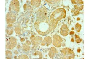 Immunohistochemistry of paraffin-embedded human pancreatic tissue using ABIN7143956 at dilution of 1:100 (ALS2 antibody  (AA 1-280))