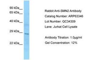 Image no. 1 for anti-SMN1 / SMN2 (AA 51-100) antibody (ABIN6749971)