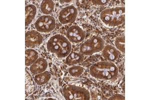 Immunohistochemical staining of human duodenum with ASCC2 polyclonal antibody  shows strong cytoplasmic positivity in glandular cells at 1:20-1:50 dilution. (ASCC2 antibody)