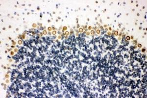 IHC analysis of Sumo 1/SUMO1 using anti-Sumo 1/SUMO1 antibody (ABIN7603002).