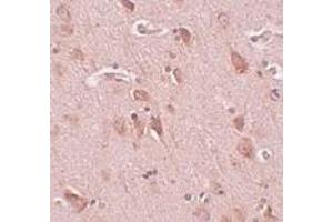 Immunohistochemistry of FAM59B in human brain tissue with FAM59B antibody at 5 μg/ml. (FAM59B antibody  (C-Term))