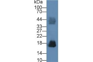 Detection of RNASE2 in Human Urine using Polyclonal Antibody to Ribonuclease A2 (RNASE2) (RNASE2 antibody  (AA 28-161))