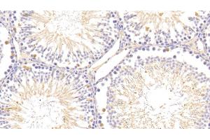 Immunohistochemistry (IHC) image for anti-Amyloid P Component, Serum (APCS) (AA 22-222) antibody (ABIN7433756)