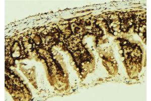 Immunohistochemistry (IHC) image for anti-Tumor Protein P53 (TP53) (pSer366) antibody (ABIN6255262)