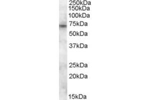 Western Blotting (WB) image for anti-Chemokine (C-X3-C Motif) Ligand 1 (CX3CL1) (Internal Region) antibody (ABIN2466643)