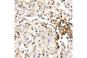 Immunohistochemistry of paraffin-embedded human liver using FBN1 Rabbit pAb (ABIN7267176) at dilution of 1:50 (40x lens). (Fibrillin 1 antibody  (AA 360-460))