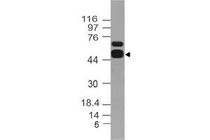 Image no. 1 for anti-Aldehyde Dehydrogenase 1 Family, Member A1 (ALDH1A1) (AA 300-500) antibody (ABIN5027482) (ALDH1A1 antibody  (AA 300-500))