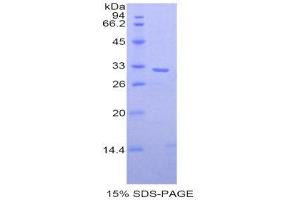 SDS-PAGE (SDS) image for Pitrilysin Metallopeptidase 1 (PITRM1) (AA 544-806) protein (His tag) (ABIN2121892)