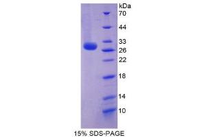 SDS-PAGE (SDS) image for Reelin (RELN) (AA 2398-2608) protein (His tag) (ABIN2126644)