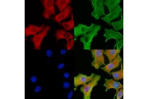 ABIN6260629 and ABIN6276912 staining Hela cells by IF/ICC. (CD47 antibody  (C-Term))