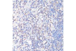 Immunohistochemistry of paraffin-embedded human appendix using CFL1 antibody. (Cofilin antibody  (AA 1-100))