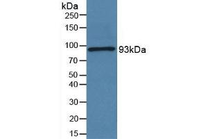Rabbit Capture antibody from the kit in WB with Positive Control: Sample Human serum. (Periostin ELISA Kit)