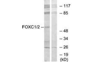 Western blot analysis of extracts from RAW264. (FOXC1 antibody  (AA 151-200))