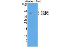 Western blot analysis of recombinant Human IGFBP1. (IGFBPI antibody  (AA 159-249))