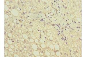 Immunohistochemistry of paraffin-embedded human liver tissue using ABIN7154045 at dilution of 1:100 (GATC antibody  (AA 1-136))