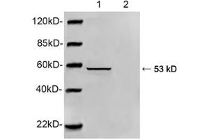 Western blot analysis of HEK293 cell lysate using 1 µg/mL Rabbit Anti-Vimentin Polyclonal Antibody (ABIN398717) Primary Antibody: Lane 1: Rabbit Anti-Vimentin Polyclonal AntibodyLane 2: Rabbit Anti-Vimentin Polyclonal Antibody pre-incubated with immunizing peptideThe signal was developed with IRDyeTM 800 Conjugated Goat Anti-Rabbit IgG (Vimentin antibody  (AA 70-120))