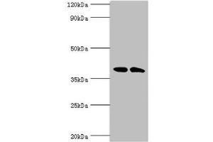 Western blot All lanes: Casein kinase I isoform alpha-like antibody at 4 μg/mL Lane 1: K562 whole cell lysate Lane 2: Hela whole cell lysate Secondary Goat polyclonal to rabbit IgG at 1/10000 dilution Predicted band size: 39 kDa Observed band size: 39 kDa (CSNK1A1L antibody  (Isoform alpha))