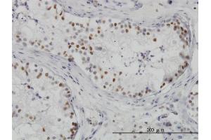 Immunoperoxidase of monoclonal antibody to HDAC1 on formalin-fixed paraffin-embedded human testis. (HDAC1 antibody  (AA 1-482))
