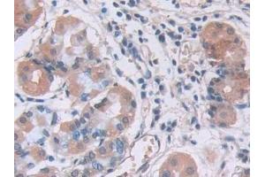 Detection of IL12A in Human Stomach Tissue using Monoclonal Antibody to Interleukin 12A (IL12A)