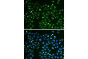 Immunofluorescence analysis of A549 cell using GPX4 antibody. (GPX4 antibody  (AA 30-197))