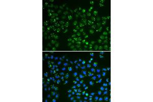 Immunofluorescence analysis of A549 cell using GPX4 antibody. (GPX4 antibody  (AA 30-197))