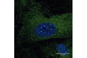 Immunofluorescence (IF) image for anti-Early Endosome Antigen 1 (EEA1) (C-Term) antibody (ABIN1439993)