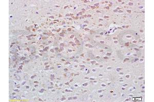Formalin-fixed and paraffin embedded rat brain tissue labeled with Anti-Tubulin-alpha Polyclonal Antibody, Unconjugated (ABIN725630) at 1:200, followed by conjugation to the secondary antibody and DAB staining (alpha Tubulin antibody  (AA 375-448))
