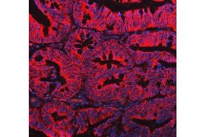 IF analysis of EML4 using anti-EML4 antibody (ABIN6719384). (EML4 antibody  (AA 207-423))
