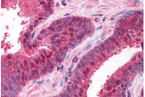 Human Prostate (formalin-fixed, paraffin-embedded) stained with PPP4C antibody ABIN214615 at 10 ug/ml followed by biotinylated goat anti-rabbit IgG secondary antibody ABIN481713, alkaline phosphatase-streptavidin and chromogen. (PPP4C antibody  (AA 294-307))