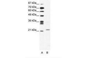 Image no. 1 for anti-Twist Homolog 1 (Drosophila) (TWIST1) (C-Term) antibody (ABIN202060) (TWIST1 antibody  (C-Term))