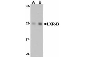 Image no. 1 for anti-Nuclear Receptor Subfamily 1, Group H, Member 2 (NR1H2) (N-Term) antibody (ABIN478107) (NR1H2 antibody  (N-Term))