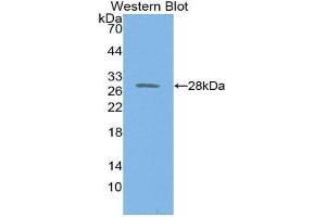 Western Blotting (WB) image for anti-Proteasome 26S Subunit, Non ATPase 9 (AA 2-223) antibody (ABIN1860343) (Proteasome 26S Subunit, Non ATPase 9 (AA 2-223) antibody)