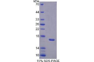 Image no. 1 for Bactericidal/Permeability Increasing Protein (BPI) (AA 320-457) protein (His tag) (ABIN4988638)
