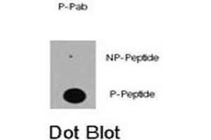 Dot blot analysis of EP300 (phospho S89) polyclonal antibody  on nitrocellulose membrane. (p300 antibody  (pSer89))