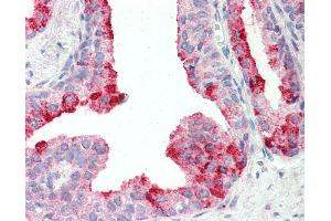 Anti-CUTA antibody IHC staining of human prostate. (CUTA antibody  (AA 185-195))