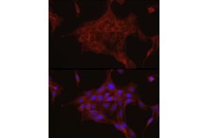 Immunofluorescence analysis of PC-12 cells using TGF beta induced (TGFBI) Rabbit pAb (ABIN3023372, ABIN3023373, ABIN3023374 and ABIN6219663) at dilution of 1:50 (40x lens). (TGFBI antibody  (AA 481-683))