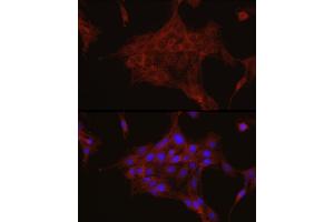 Immunofluorescence analysis of PC-12 cells using TGF beta induced (TGFBI) Rabbit pAb (ABIN3023372, ABIN3023373, ABIN3023374 and ABIN6219663) at dilution of 1:50 (40x lens).