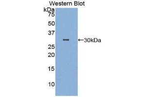 Western Blotting (WB) image for anti-DNA Fragmentation Factor, 40kDa, beta Polypeptide (Caspase-Activated DNase) (DFFB) (AA 87-323) antibody (ABIN3207309)