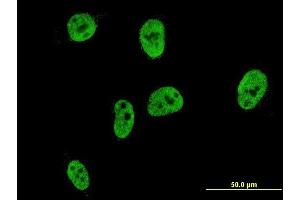 Immunofluorescence of monoclonal antibody to CDX1 on HeLa cell. (CDX1 antibody  (AA 126-215))