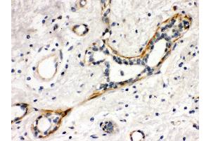 Immunohistochemistry (IHC) image for anti-V-Yes-1 Yamaguchi Sarcoma Viral Oncogene Homolog 1 (YES1) (AA 7-35), (N-Term) antibody (ABIN3042333)