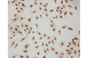 Immunocytochemistry (ICC) image for anti-LIM and SH3 Protein 1 (LASP1) (AA 16-30) antibody (ABIN3031619)